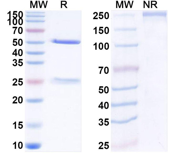 Anti-Human TRO/KIAA1114 Recombinant Monoclonal Antibody (SAA1943) - SDS-PAGE
