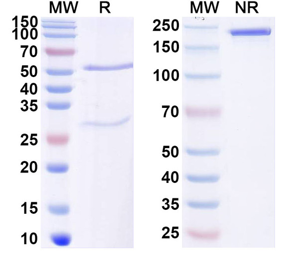 Anti-Human ABCC3/MRP3 Recombinant Monoclonal Antibody (SAA1949) - SDS-PAGE