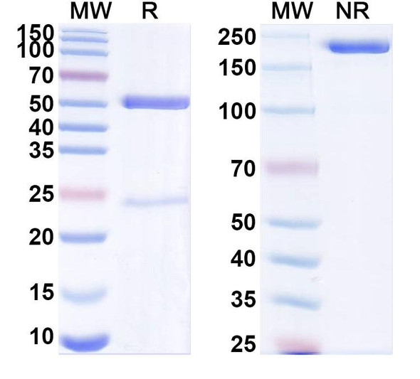 Anti-Human HCRTR1/OX1R Recombinant Monoclonal Antibody (SAA1954) - SDS-PAGE