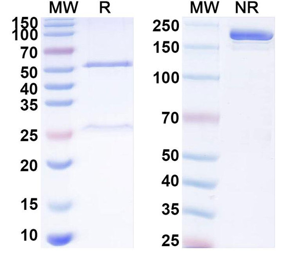 Anti-Human F2RL1/PAR-2 Recombinant Monoclonal Antibody (SAA1956) - SDS-PAGE