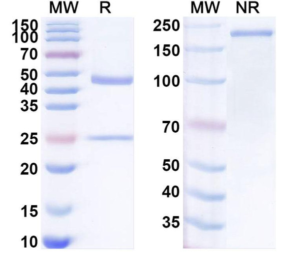 Anti-Human DDX4/Vasa Recombinant Monoclonal Antibody (SAA1970) - SDS-PAGE