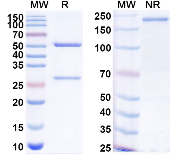 Anti-Human VIPR1/VPAC1 Recombinant Monoclonal Antibody (SAA1972) - SDS-PAGE