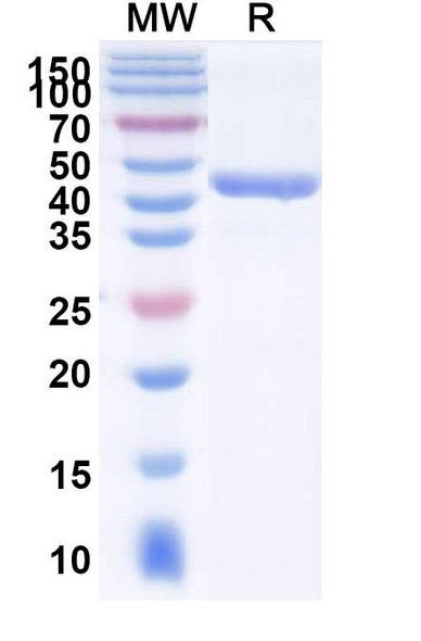 Anti-Human SLC4A7 Recombinant Monoclonal Antibody (SAA1974) - SDS-PAGE