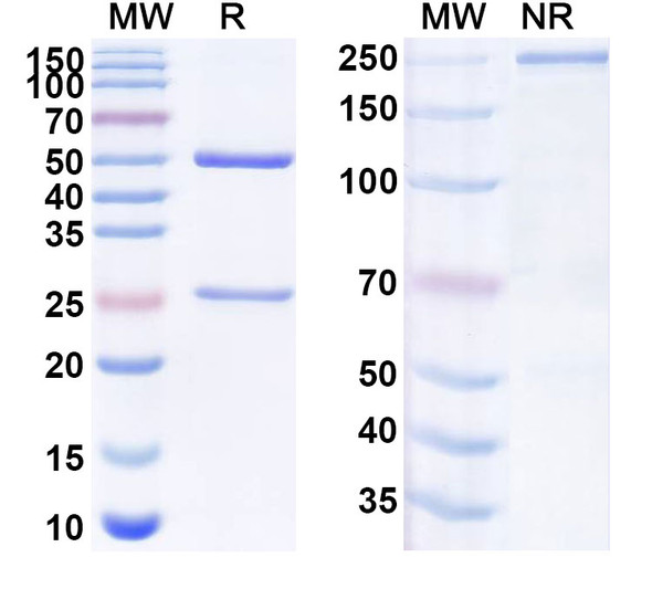 Anti-Human TNFAIP6/TSG-6 Recombinant Monoclonal Antibody (SAA1977) - SDS-PAGE