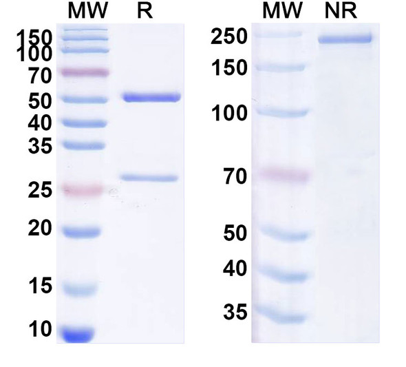 Anti-Human ITGA10/Integrin α10 Recombinant Monoclonal Antibody (SAA1980) - SDS-PAGE