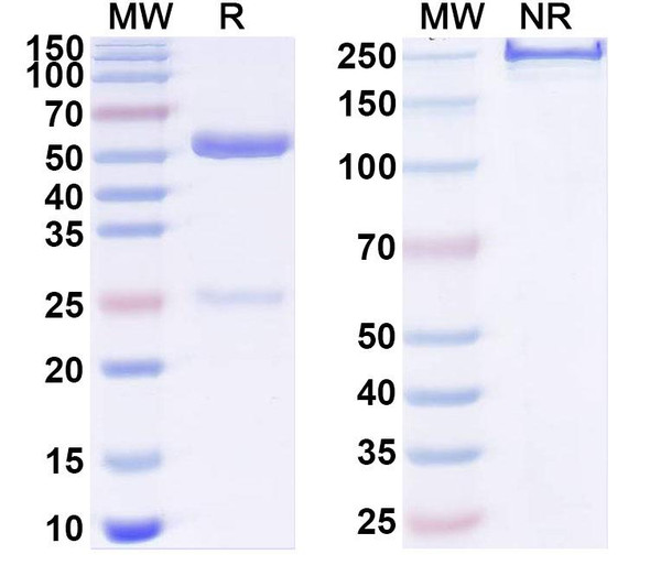 Anti-Human ITGB7 Recombinant Monoclonal Antibody (SAA1982) - SDS-PAGE