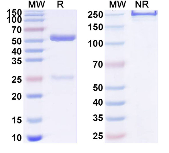 Anti-Human CD215/IL15RA Recombinant Monoclonal Antibody (SAA1984) - SDS-PAGE