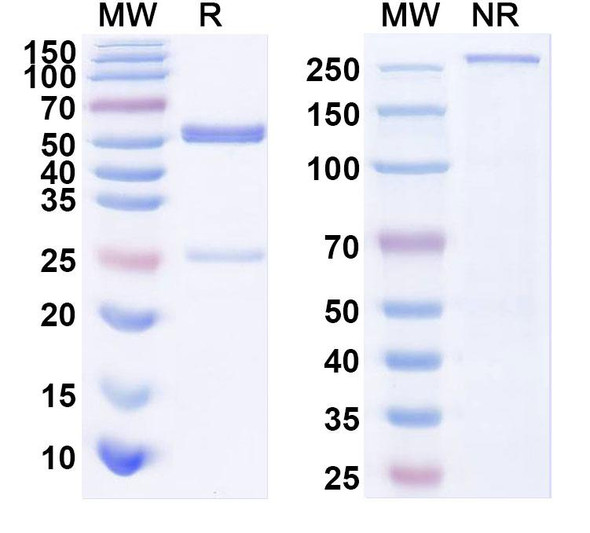 Anti-Human APP/Amyloid beta Recombinant Monoclonal Antibody (PFA1) - SDS-PAGE