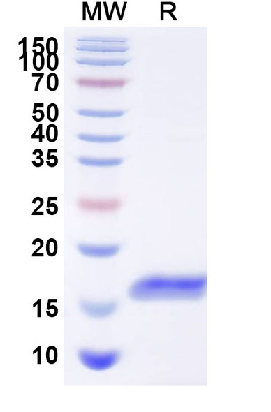 Anti-Human GPC3 Recombinant Nanobody (HN3) - SDS-PAGE