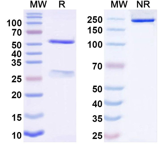 Anti-Neisseria meningitidis NHBA/Dextranase Recombinant Monoclonal Antibody (10C3) - SDS-PAGE