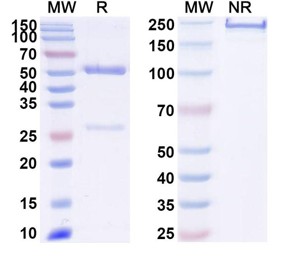 Anti-Neisseria meningitidis NHBA/Dextranase Recombinant Monoclonal Antibody (12E1#) - SDS-PAGE
