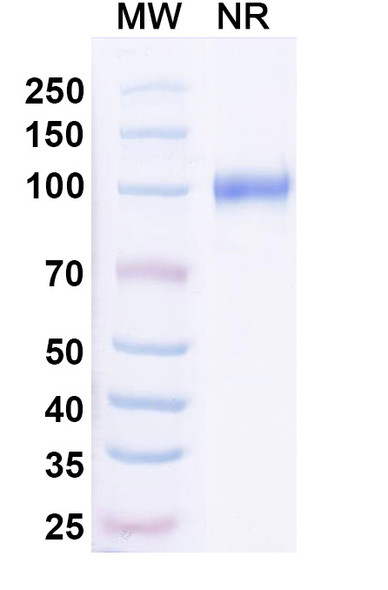 Anti-Neisseria meningitidis NadA/Neisseria adhesin A Recombinant Monoclonal Antibody (G9) - SDS-PAGE