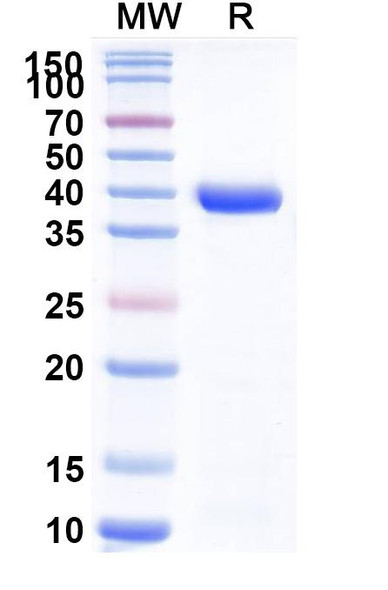 Anti-Neisseria meningitidis NadA/Neisseria adhesin A Recombinant Monoclonal Antibody (F3) - SDS-PAGE