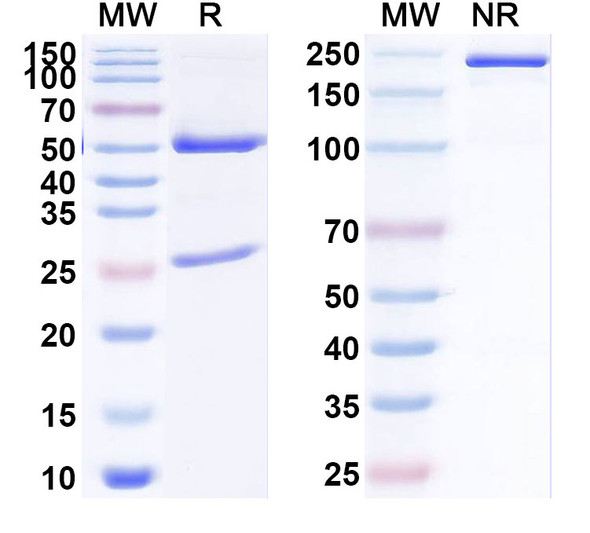 Anti-Human HLA-DQB1 Recombinant Monoclonal Antibody (LG11) - SDS-PAGE