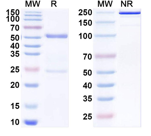 Anti-Human HLA-DRA/DRB4 Recombinant Monoclonal Antibody (GPC-8-6) - SDS-PAGE