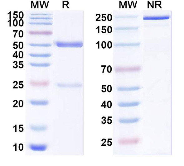 Anti-Human HLA-DRA/DRB4 Recombinant Monoclonal Antibody (GPC-8-6-47) - SDS-PAGE
