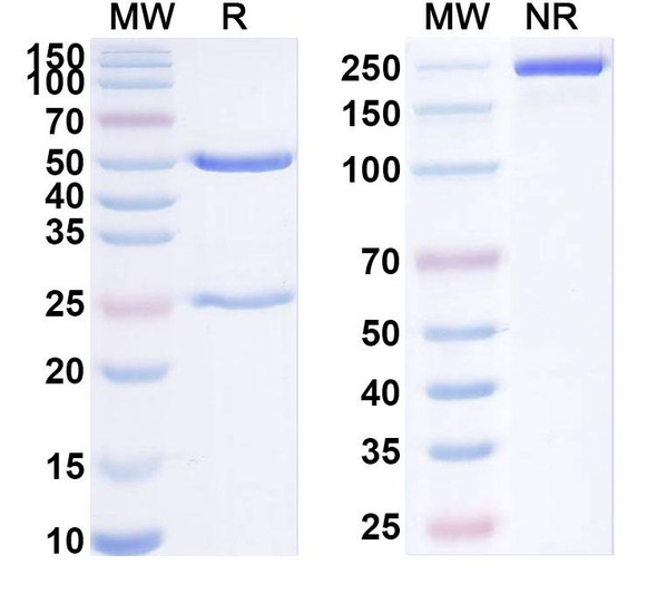 Anti-Human HLA-DRA/DRB4 Recombinant Monoclonal Antibody (GPC-8-27-10) - SDS-PAGE