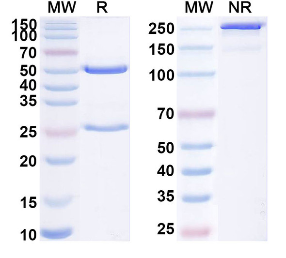 Anti-Human HLA-DRA/DRB4 Recombinant Monoclonal Antibody (scFv-E6) - SDS-PAGE