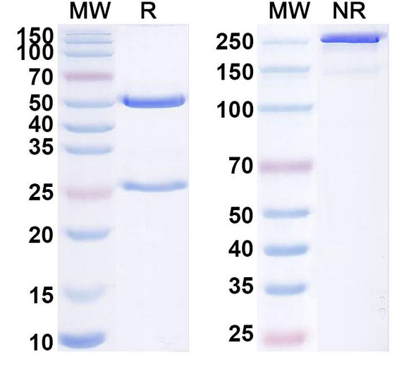 Anti-Human HLA-DRA/DRB4 Recombinant Monoclonal Antibody (scFv-E6) - SDS-PAGE