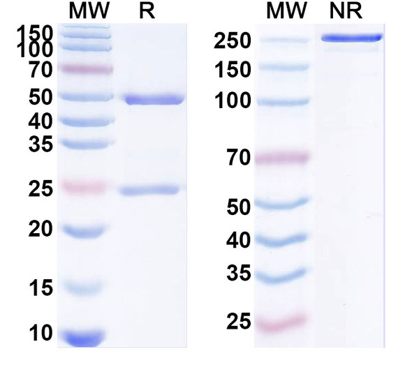 Anti-Human HLA-G Recombinant Monoclonal Antibody (37268#) - SDS-PAGE