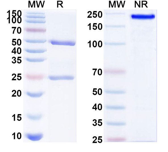 Anti-Human HLA-G Recombinant Monoclonal Antibody (37271#) - SDS-PAGE