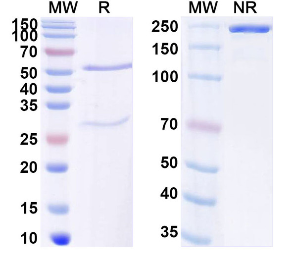 Anti-Human HLA-G Recombinant Monoclonal Antibody (38418#) - SDS-PAGE