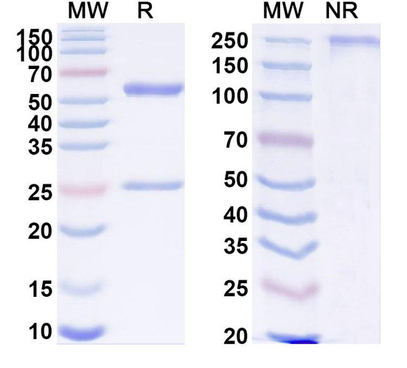 Anti-Human HLA-G Recombinant Monoclonal Antibody (38420#) - SDS-PAGE