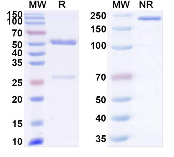 Anti-Human HLA-G Recombinant Monoclonal Antibody (37323#) - SDS-PAGE