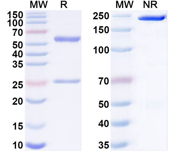 Anti-Human HLA-G Recombinant Monoclonal Antibody (33299#) - SDS-PAGE