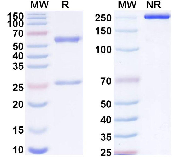 Anti-Human HLA-G Recombinant Monoclonal Antibody (33357#) - SDS-PAGE