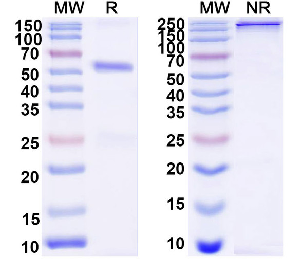 Anti-Bovine Serum Albumin/BSA Recombinant Monoclonal Antibody (12E1#) - SDS-PAGE