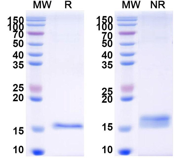 Anti-PRRSV RNA-directed RNA polymerase/NSP9 Recombinant Nanobody (Nb8) - SDS-PAGE
