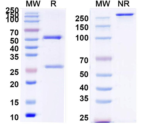 Anti-Human IL6 Recombinant Monoclonal Antibody (SAA2009) - SDS-PAGE