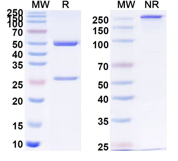 Anti-Human CD340/ERBB2/HER2 Recombinant Monoclonal Antibody (SAA2012) - SDS-PAGE