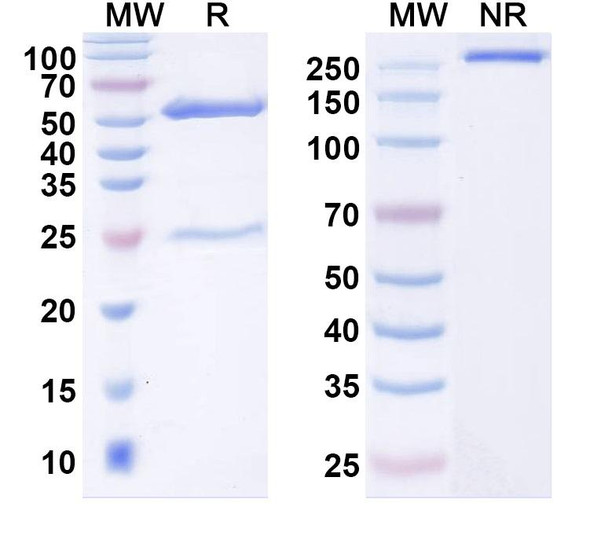 Anti-EV71 Capsid protein VP1/2/3 Recombinant Monoclonal Antibody (SAA2027) - SDS-PAGE