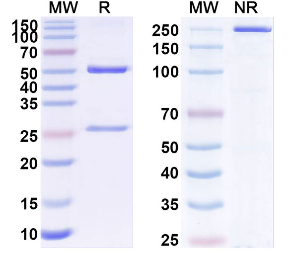 Anti-ANO9/TMEM16J Recombinant Monoclonal Antibody (N443/17) - SDS-PAGE