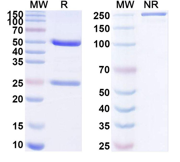 Anti-Foxi3 Recombinant Monoclonal Antibody (N359/47) - SDS-PAGE