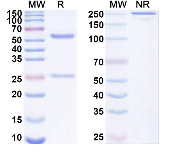 Anti-Slo3 K+ channel Recombinant Monoclonal Antibody (N2/16) - SDS-PAGE
