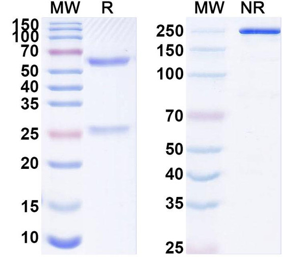 Anti-CCRL2 Recombinant Monoclonal Antibody (N184/12) - SDS-PAGE