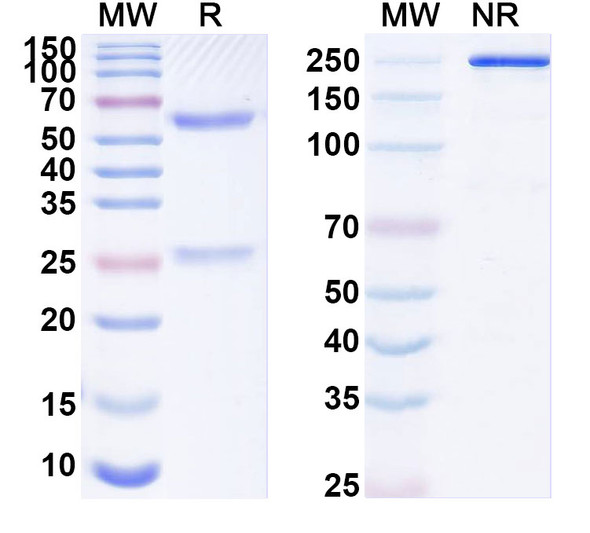 Anti-CCRL2 Recombinant Monoclonal Antibody (N184/18) - SDS-PAGE