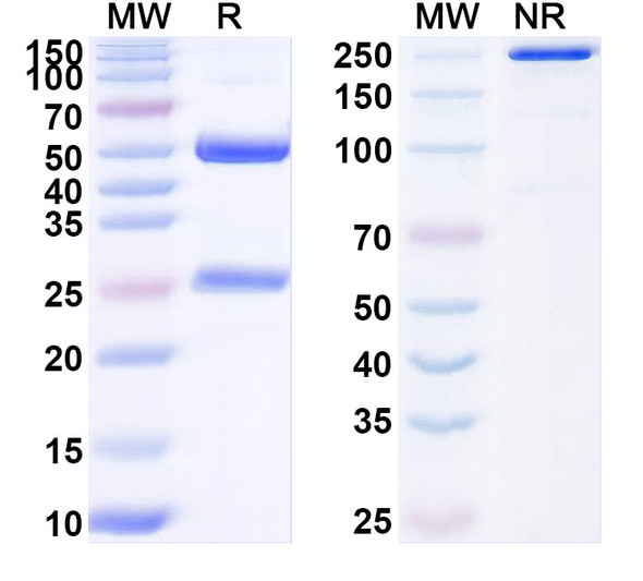 Anti-BIN1/Amphiphysin-II Recombinant Monoclonal Antibody (N481/33) - SDS-PAGE