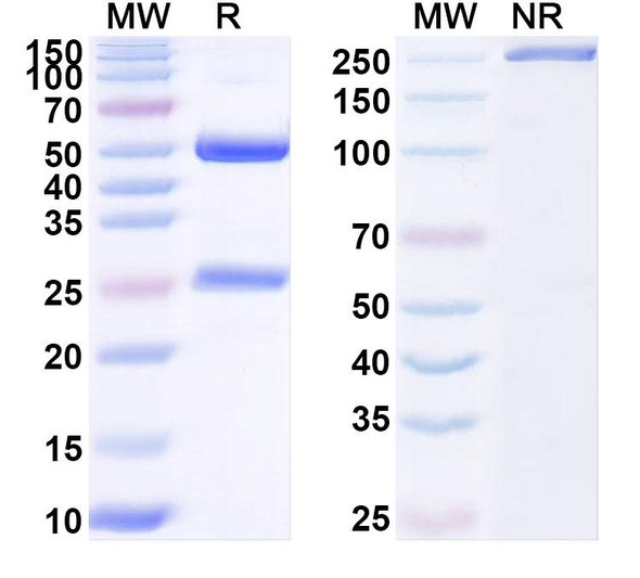 Anti-PEX7 Recombinant Monoclonal Antibody (N232/5) - SDS-PAGE