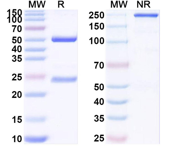 Anti-SAPAP1 Recombinant Monoclonal Antibody (N238/30) - SDS-PAGE