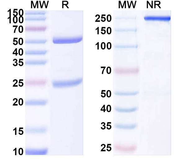 Anti-TASK1 K+ channel Recombinant Monoclonal Antibody (N374/25) - SDS-PAGE
