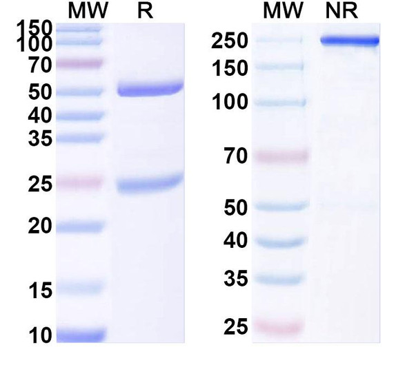 Anti-TASK1 K+ channel Recombinant Monoclonal Antibody (N374/47) - SDS-PAGE