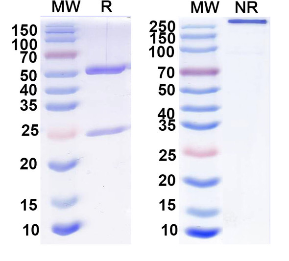 Anti-Complex spinal cord protein sample Recombinant Monoclonal Antibody (L7/3) - SDS-PAGE