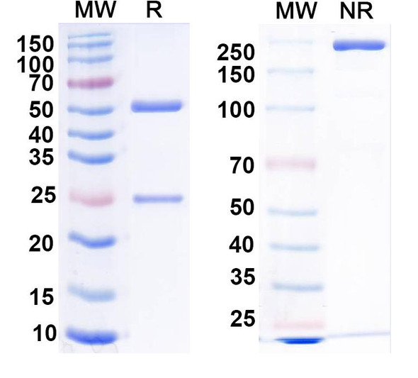 Anti-Collybistin Recombinant Monoclonal Antibody (L120/30) - SDS-PAGE