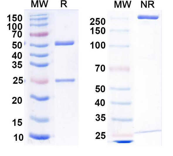 Anti-RGS14 Recombinant Monoclonal Antibody (N133/11) - SDS-PAGE