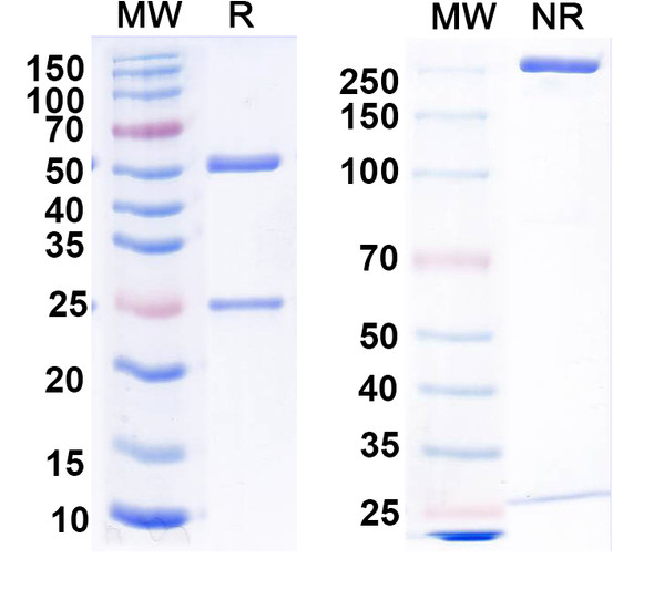 Anti-RGS14 Recombinant Monoclonal Antibody (N133/35) - SDS-PAGE