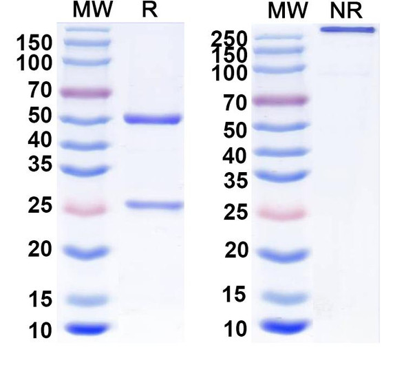 Anti-GalR2 Recombinant Monoclonal Antibody (N407A/85) - SDS-PAGE